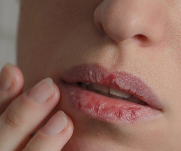 4 Best Winter Skincare Routine